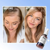 FEGPlus Minoxidil Beard & Hair Growth Serum