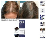 FEG Hair Growth Spray